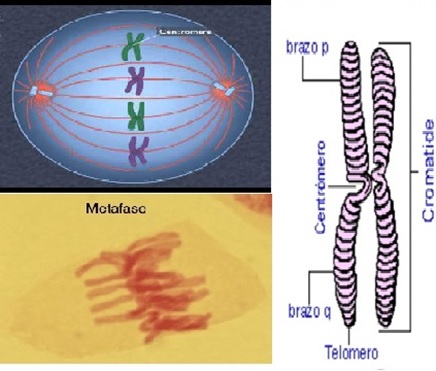 Cromosoma metafásico.jpg